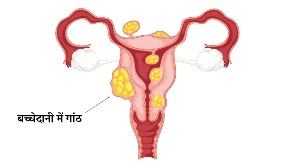 गर्भाशय स्वास्थ्य के लिए सही डाइट गाइड | NovaKhabar